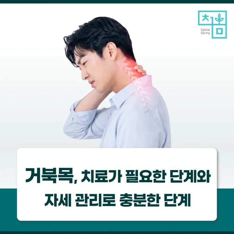 거북목, 치료가 필요한 단계와 자세 관리로 충분한 단계