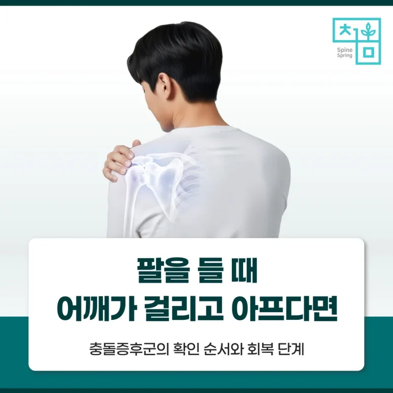 팔을 들 때 어깨가 걸리고 아프다면 — 충돌증후군의 확인 순서와 회복 단계