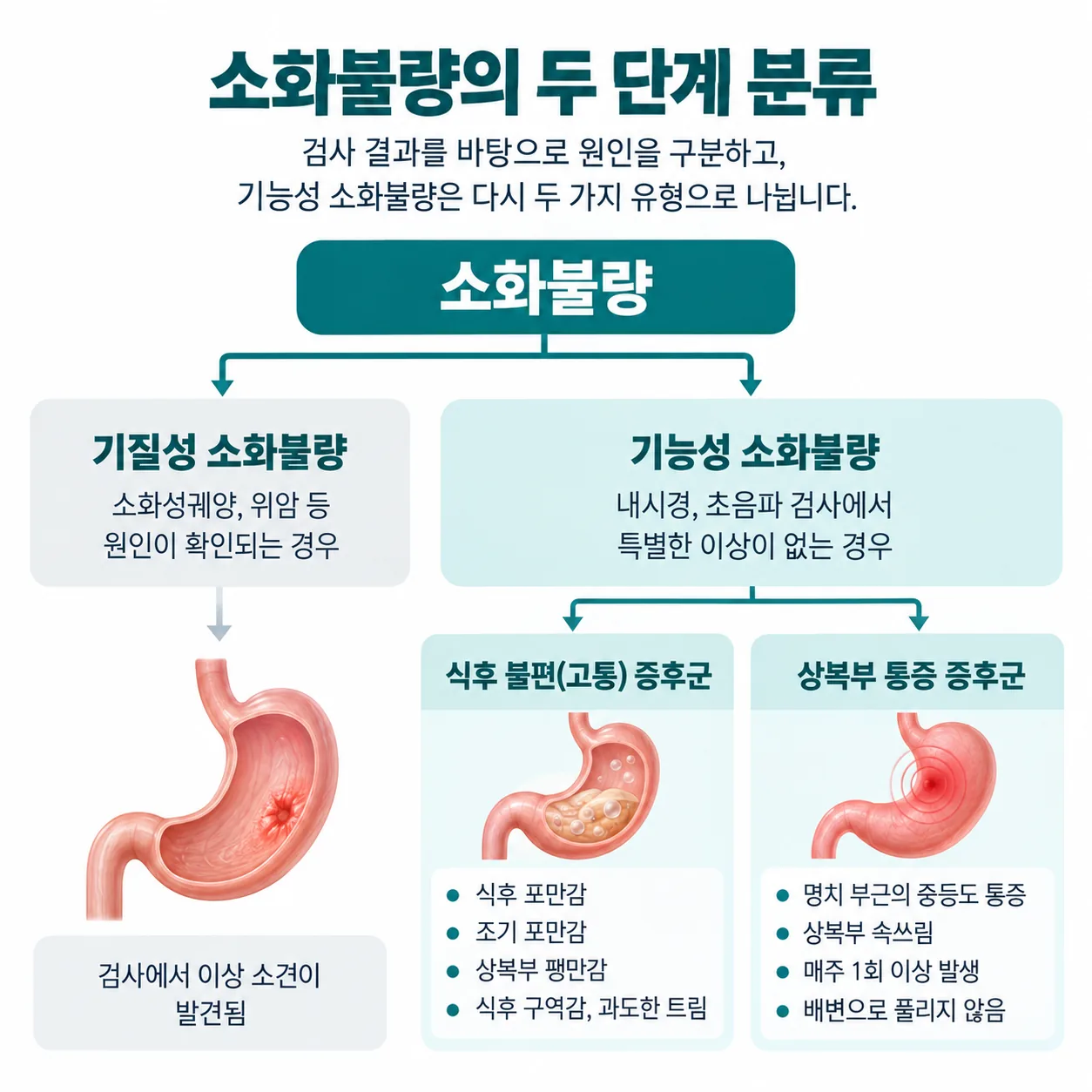 소화불량을 기질성·기능성으로 나누고 기능성을 다시 두 유형으로 구분한 개념도