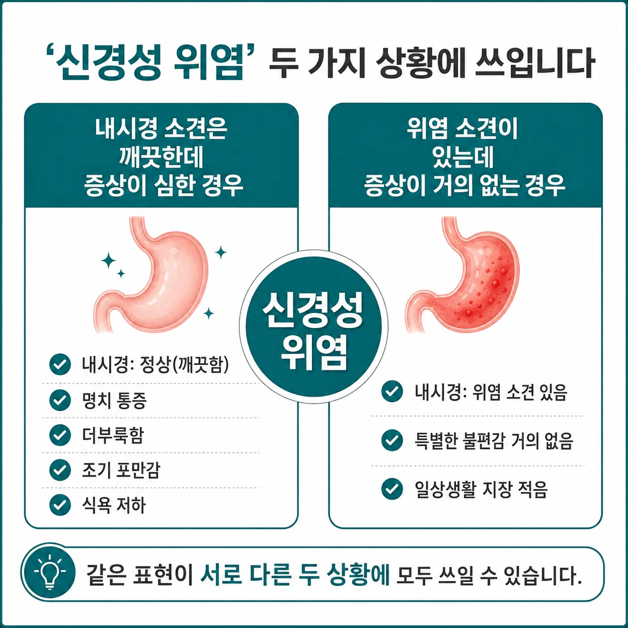 신경성 위염이라는 표현이 서로 다른 두 상황에 쓰이는 것을 비교한 도식