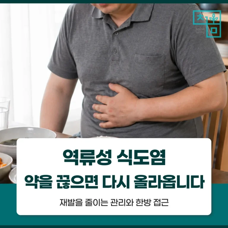 역류성 식도염, 약을 끊으면 다시 올라옵니다 — 재발을 줄이는 관리와 한방 접근
