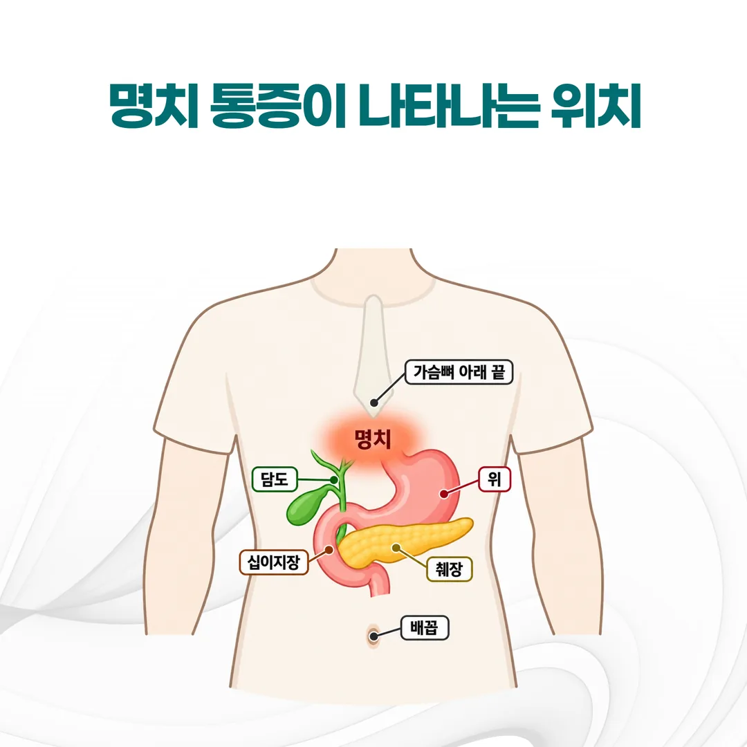 명치의 위치와 그 자리에 겹쳐 있는 위·십이지장·췌장·담도를 나타낸 그림